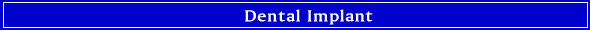 Dental Implant